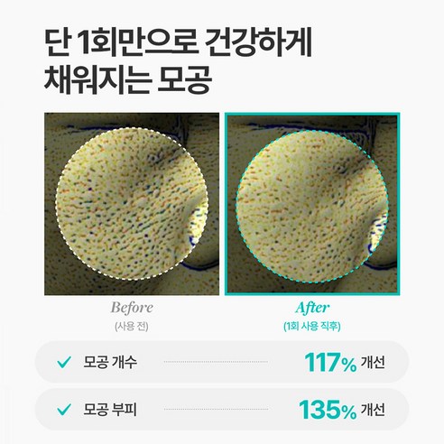 메디테라피 포쎄라 리얼 비피다 블러 크림 솔직 후기 | 실사용자 리뷰 분석 - 상품 이미지 4