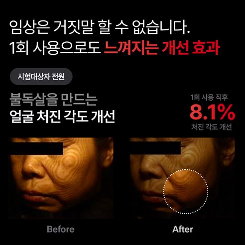 집에서 전문가처럼, 피부 탄력 고민 끝
