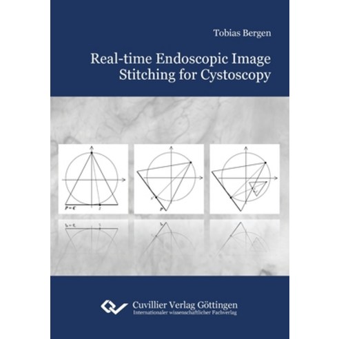 (영문도서)Real-time Endoscopic Image Stitching for Cystoscopy Paperback, Cuvillier, English, 9783736996465