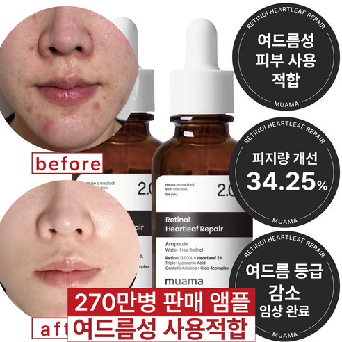 여드름성 피부 사용 적합 사춘기 트러블 진정 개선 흉터 모공감소 피지연화 5종 임상완료 [누적 270만병] 고함량 나이아신아마이드 레티놀 어성초 히알루론산 뮤아마 앰플 세럼, 2개, 30ml