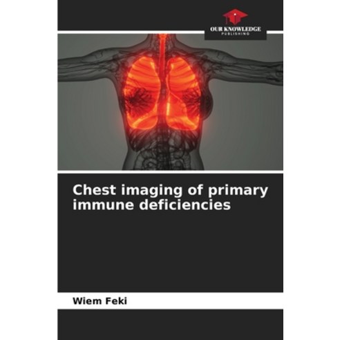 (영문도서)Chest imaging of primary immune deficiencies Paperback, Our Knowledge Publishing, English, 9786209272233