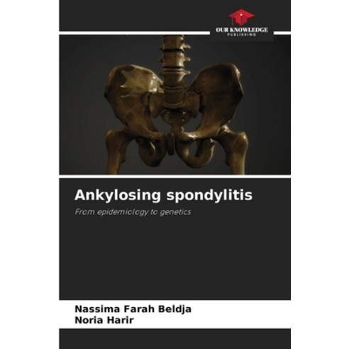 (영문도서)Ankylosing spondylitis Paperback, Our Knowledge Publishing, English, 9786209580413