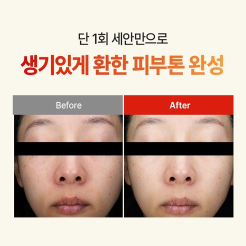 마미케어 모공 미백 애사비 클렌저 200ml+10ml 세트 솔직 후기 | 실사용자 리뷰 분석 - 상품 이미지 2