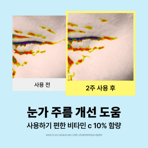 직택 앰플 세럼 순수 비타민C 10% 수분 기미 잡티 색소침착 미백 화이트닝 이미지 4