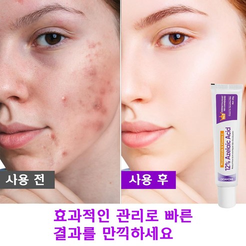 [빠른 발송] 12% 아젤-라-산 크림|지성 피부|피지/모공 관리/잡티 케어|무자극 데일리 톤업 크림 DIDAHOME 이미지 2