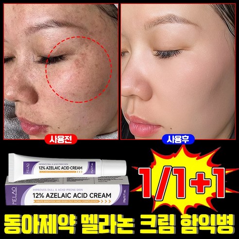 함익병 멜라논 크림