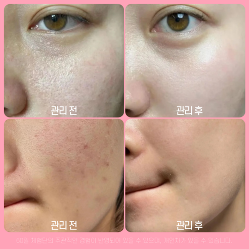 알엑스더마 EGF 시카 크림 세라마이드 판테놀 병풀 피부과 입점 피부장벽 리페어 이미지 2
