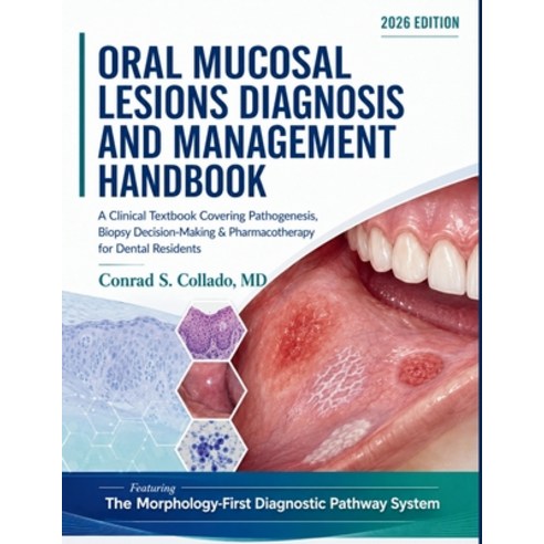 (영문도서)Oral Mucosal Lesions Diagnosis and Management Handbook: A Clinical Textbook Cove... Paperback, Independently Published, English, 9798189362422