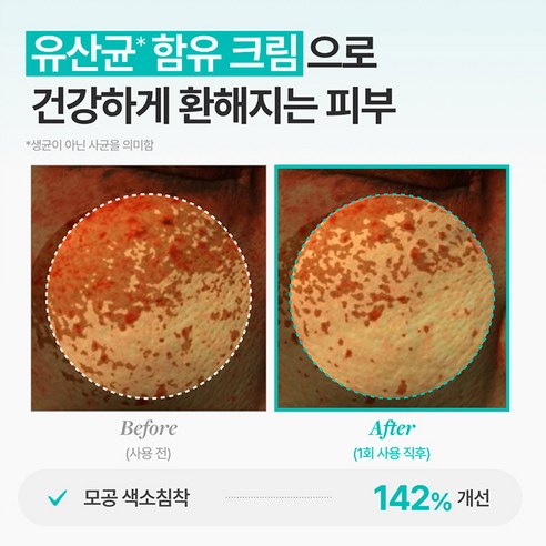 메디테라피 포쎄라 리얼 비피다 블러 크림 이미지 3