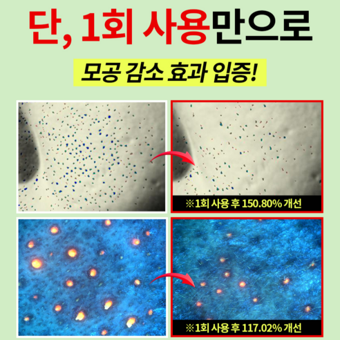 마미케어 핑구 콜라보 5초 모공 축소 바다포도 리프팅 약국 앰플 + 크림 솔직 후기 | 피부 타입별 분석 - 상품 이미지 3