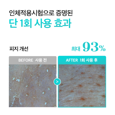 모공블러패치 | 에슬 에셀라이트 센텔라 포어리스 나비존 패치 이미지 2
