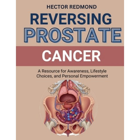 (영문도서)Reversing Prostate Cancer: A Resource for Awareness Lifestyle Choices and Pers... Paperback, Independently Published, English, 9798270798062