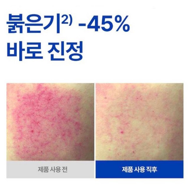 아이소이 아크니 닥터 퍼스트 스피디 스팟 앰플 이미지 4