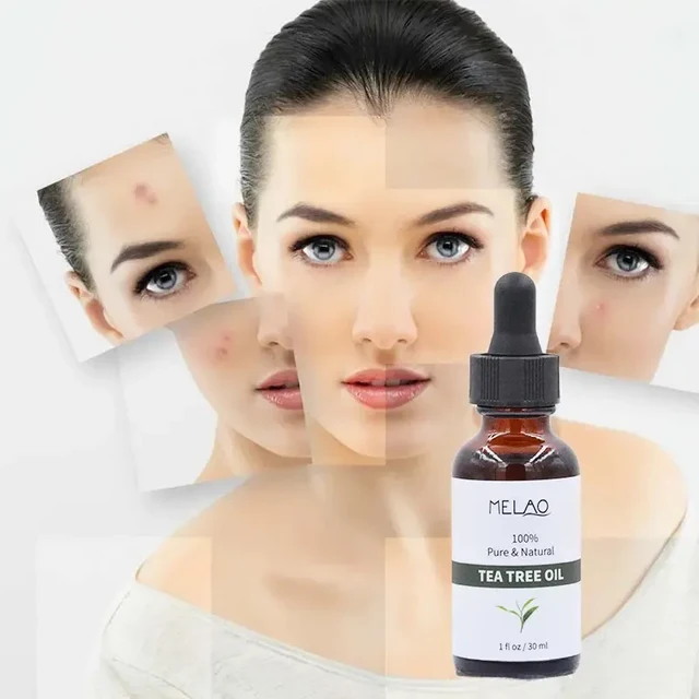 순수 천연 100% 티트리 오일30ml 이미지 3