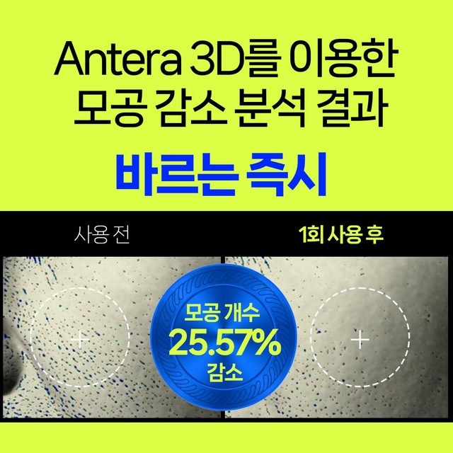 더멜릭스 PDRN EGF 피디알엔 포어 타이트닝 모공 탄력 수축 크림 솔직 후기 | 실사용자 리뷰 분석 - 상품 이미지 2