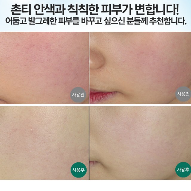 메르필 붉은기 안색개선 홍조 크림 & 수면팩 SET / 트러블 자국/민감... 솔직 후기 | 피부 타입별 분석 - 상품 이미지 3