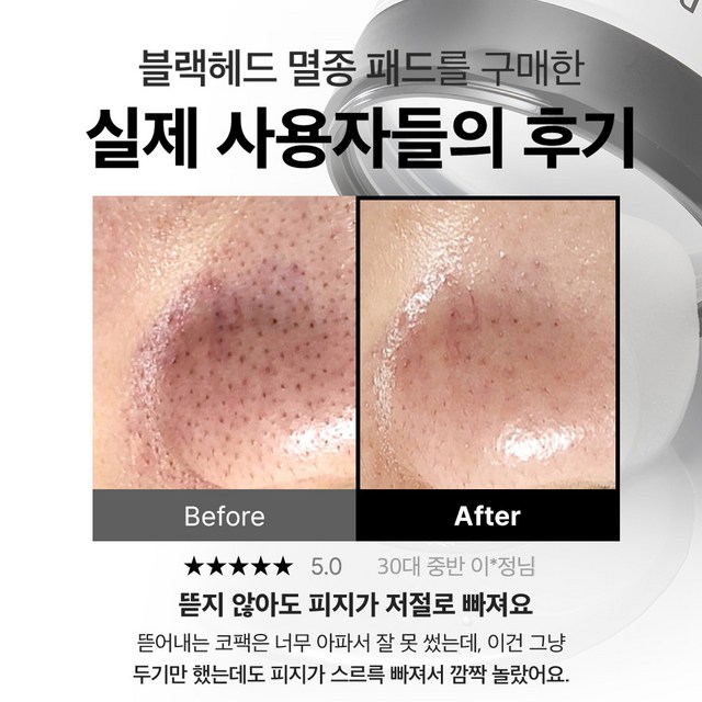 성분에디터 블랙헤드 멜팅 클리어 패드 솔직 후기 | 피부 타입별 분석 - 상품 이미지 2