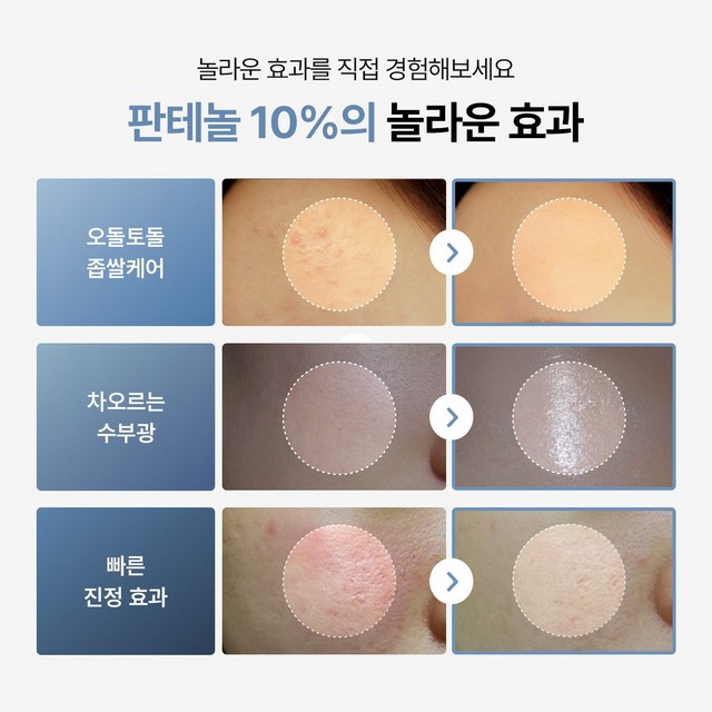 투데이위드 소프트 모이스쳐 판테놀 10% 속보습 수분크림 이미지 2