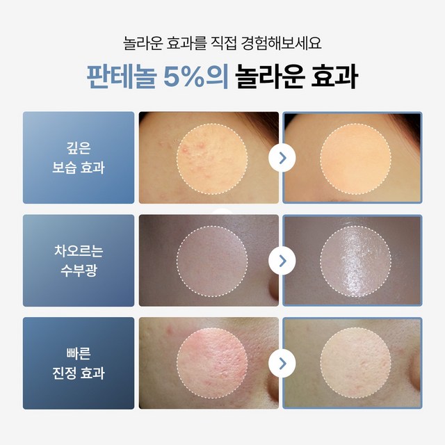 투데이위드 소프트 모이스쳐 판테놀 5% 에센스로션 솔직 후기 | 실사용자 리뷰 분석 - 상품 이미지 2