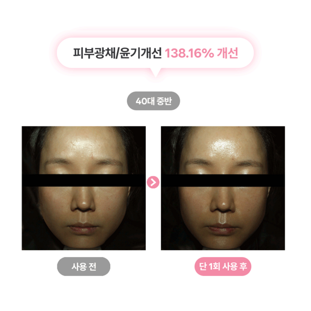 펄리 엑소좀 피부과 재생크림 여성 수분크림1위 물광크림 히알루론산 수분크림 이미지 4