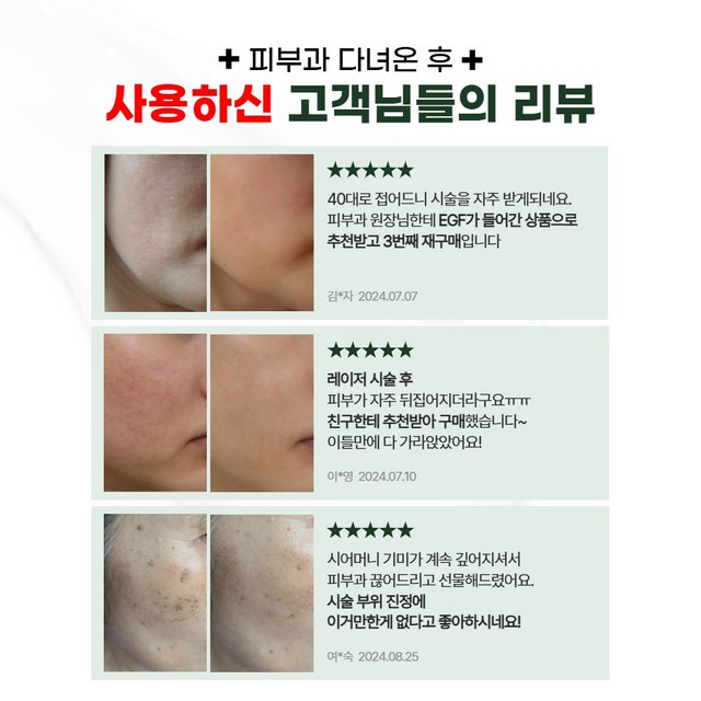 위자드랩 피부과 EGF 시카 레이저 시술 후 관리 그린 매직 리페어 크림 이미지 4