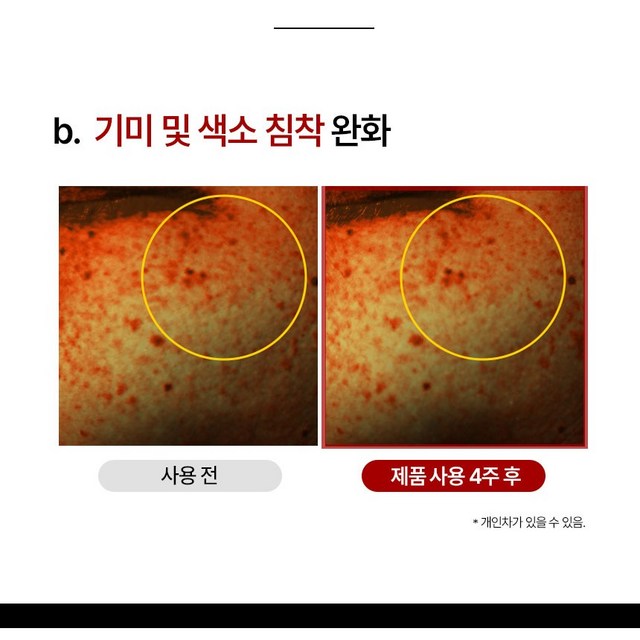 [고함량 기미 억제] 기미 잡티 빅토나인 기미크림 트라넥삼산 대용량 색소... 솔직 후기 | 실사용자 리뷰 분석 - 상품 이미지 2