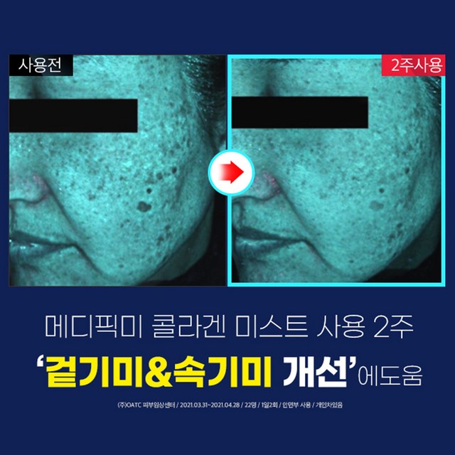 메디픽미 물광미스트 속건조미스트 페이셜미스트 수분스프레이 뿌리는미스트 스... 솔직 후기 | 실사용자 리뷰 분석 - 상품 이미지 2