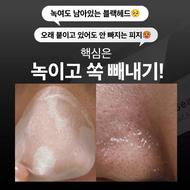 성분에디터 블랙헤드 멜팅 클리어 패드 솔직 후기 | 피부 타입별 분석 - 상품 이미지 3