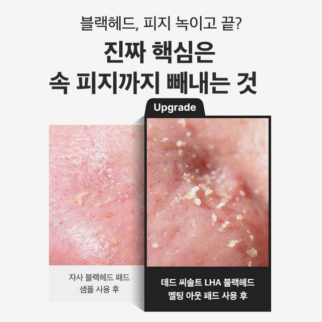 성분에디터 블랙헤드 멜팅 클리어 패드 이미지 4