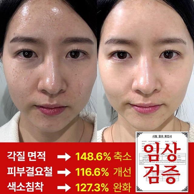 마미케어 완판 한방 요철 피부결 좁쌀 튜브형 고영양 율무크림 홈쇼핑 방송상품 이미지 3