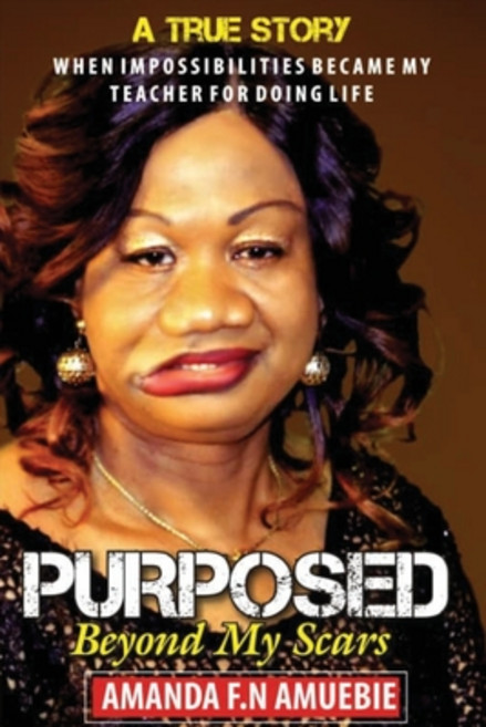 Purposed Beyond My Scars: When impossibilities Became My Teacher For Doing Life 平裝版, 65000, 英文