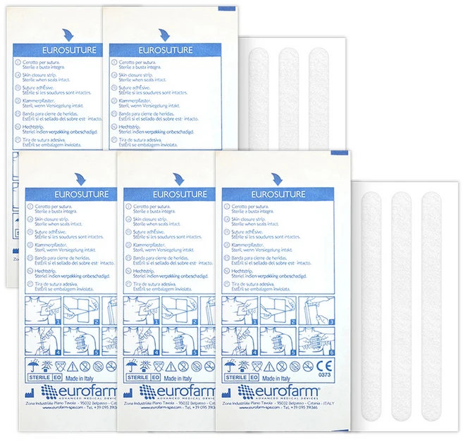eurofarm 유로슈처 의료용 봉합 유지기 717430, 3개입, 5개 - 쿠팡
