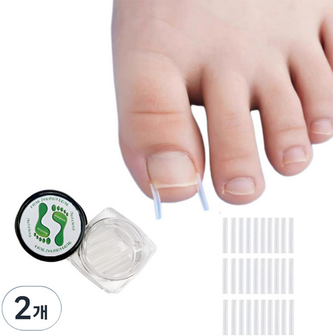 일상픽 파고드는 발톱 셀프 케어 관리 30p, 2개