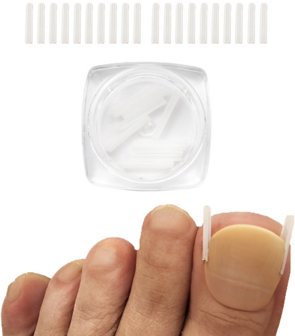 떼루와 파고드는 발톱 도움 셀프 관리 용품 20P, 1세트