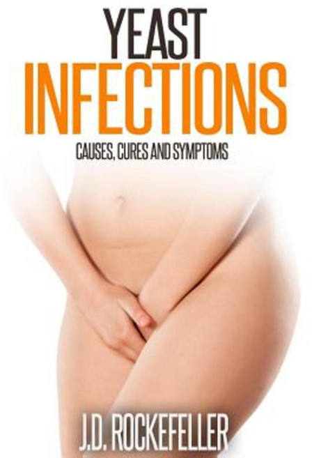Yeast Infections: Causes Cures and Symptoms Paperback, Createspace Independent Publishing Platform