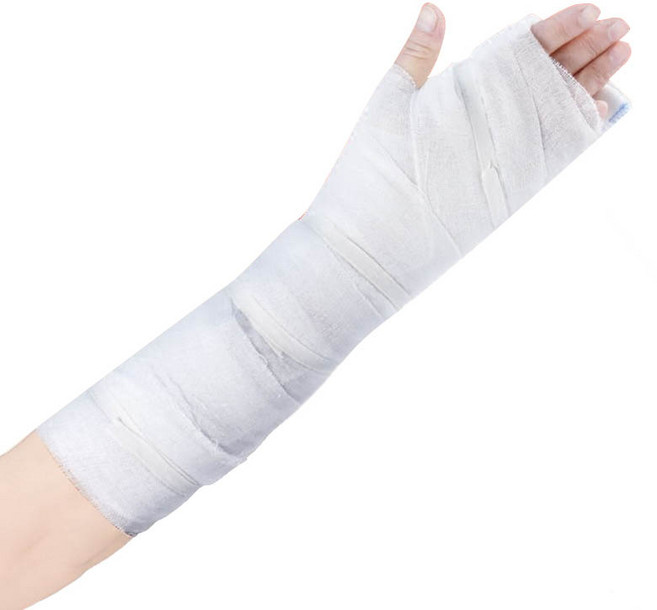 파티복닷컴 가짜 팔 깁스 소품, 화이트, 1개