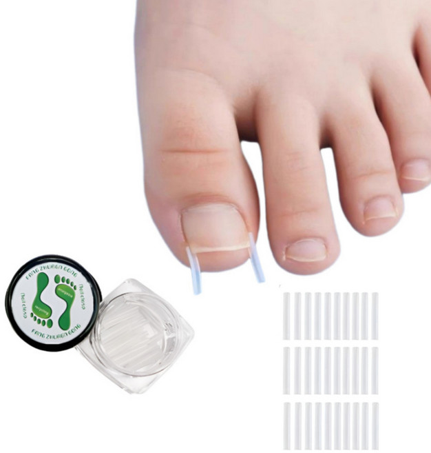 일상픽 파고드는 발톱 셀프 케어 관리 30p, 1개