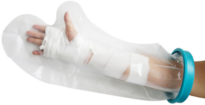 헬스퍼스트 방수 깁스 커버 성인용 팔 M, 1개