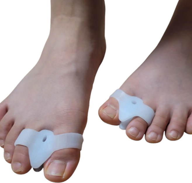 몰앤모어 발가락 링 분리기, 4개