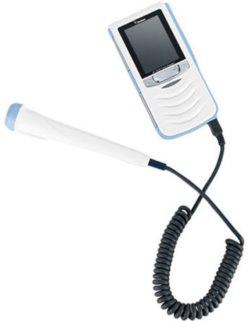 하이베베 스페셜 태아 초음파 측정기 화이트, 1개