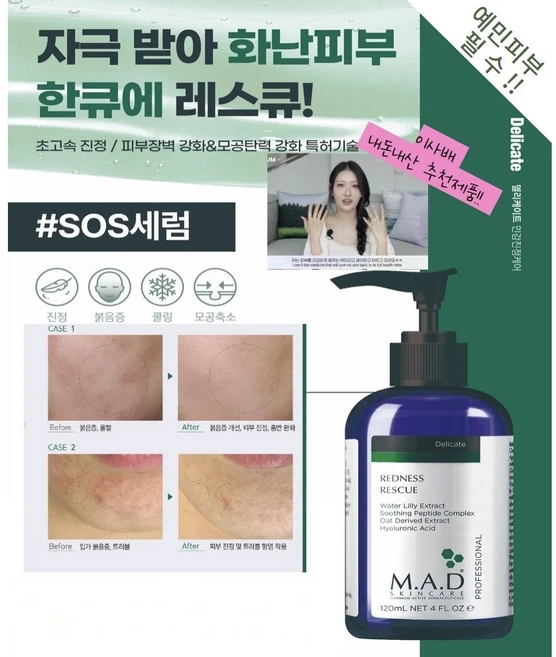 매드스킨케어 레드니스 레스큐, 120ml, 1개 - 쿠팡
