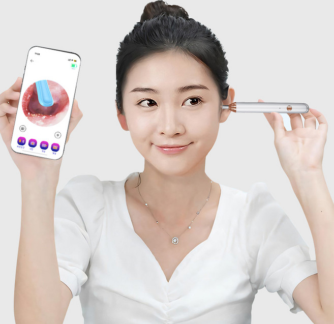 FONOW 내시경 귀이개 무선 LED 조명 1500W 고화질 스마트 카메라 귀이개, 1개