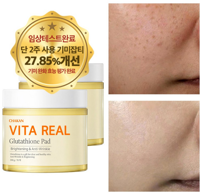기미 잡티 주근깨 화이트닝 미백 비타민 글루타치온 토너 패드, 2개, 70매입