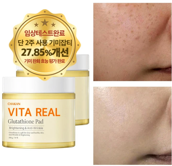 기미 잡티 주근깨 화이트닝 미백 비타민 글루타치온 토너 패드, 2개, 70매입 - 쿠팡