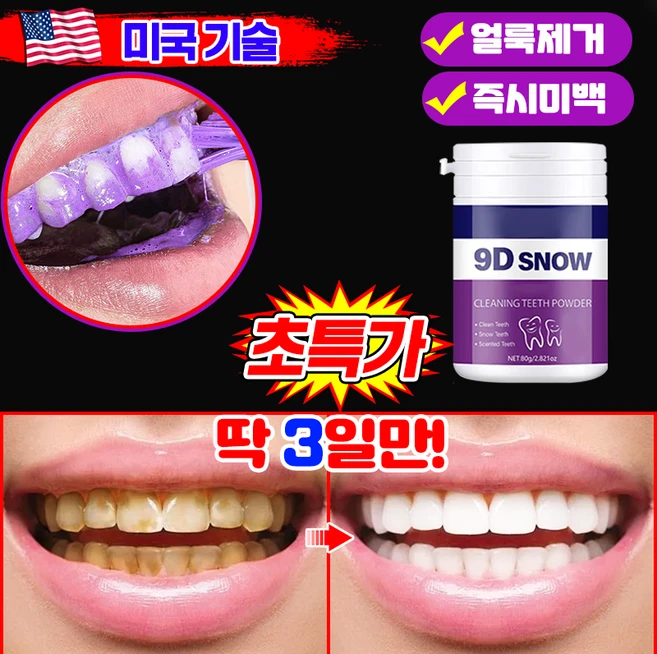 [치과추천1위] 퍼플 가루 치약 치아 관리 파우더 화이트닝 누렁니 미백 조색 흡연 커피 착색 클리닝 치석 얼룩 제거, 2개 - 쿠팡
