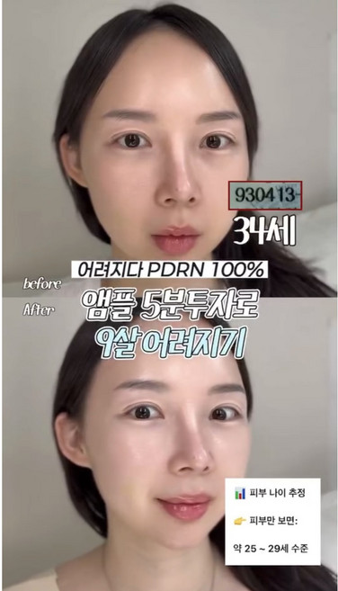 어려지다 PDRN 100% 나이아신아마이드 히알루론산 앰플 세럼 에센스, 30g, 1개