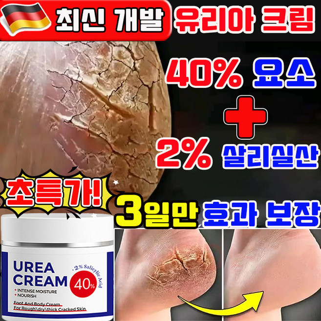유리아 크림 유리아 풋크림 함익병 유레아 크림 피부연화제 유리아크림 함익병 유레아 크림 뒷꿈치 고보습 유레아 크림 100% 발바닥 각질제거 크림 사은품 랜덤 증정, 1개, 100g