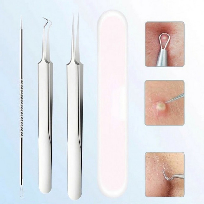피지 여드름 제거 압출 압출기 블랙헤드 비립종 뾰루지 바늘 짜는 도구 얼굴 눈 코 핀셋 집게 족집게, 1개, 3종세트