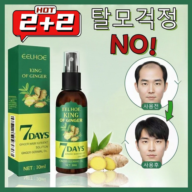 미국기술 1/1+1/2+2 두피 영양제 머리 발모제 모발 성장 촉진 에센스 탈모 방지 완화 두피케어 세럼 포장증정, 2개, 30ml