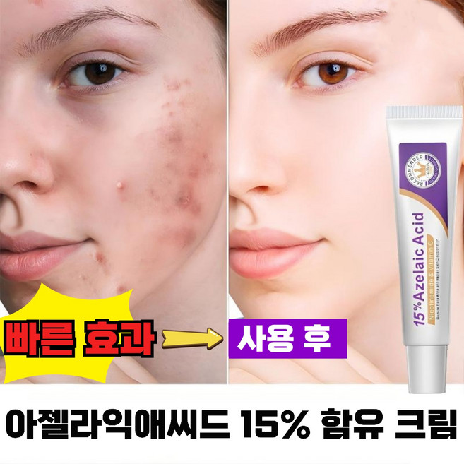 동화제약멜라논크림 고르는 법 — 구매 전 체크리스트 2026